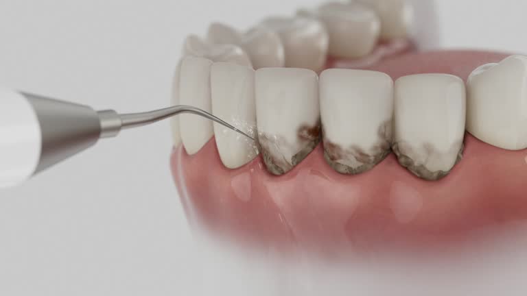 Trusted Root Canal Treatment service in Beltsville, MD - Dentist Open Now